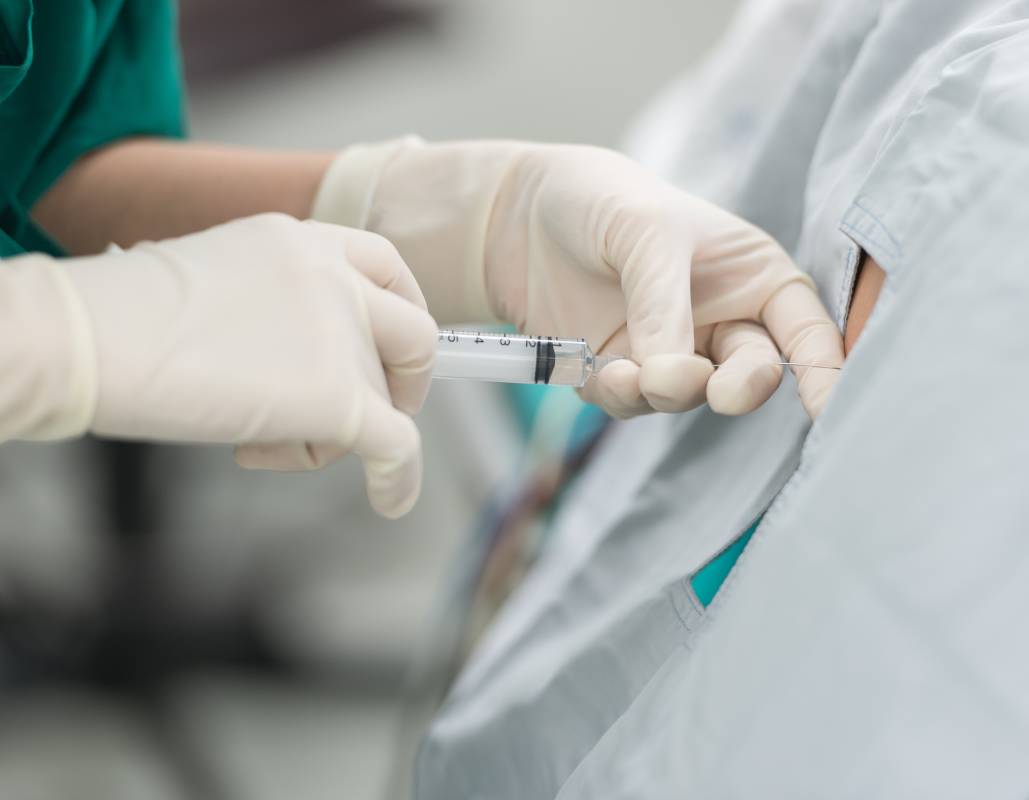 Labor Epidurals vs. Other Neuraxial Anesthesia