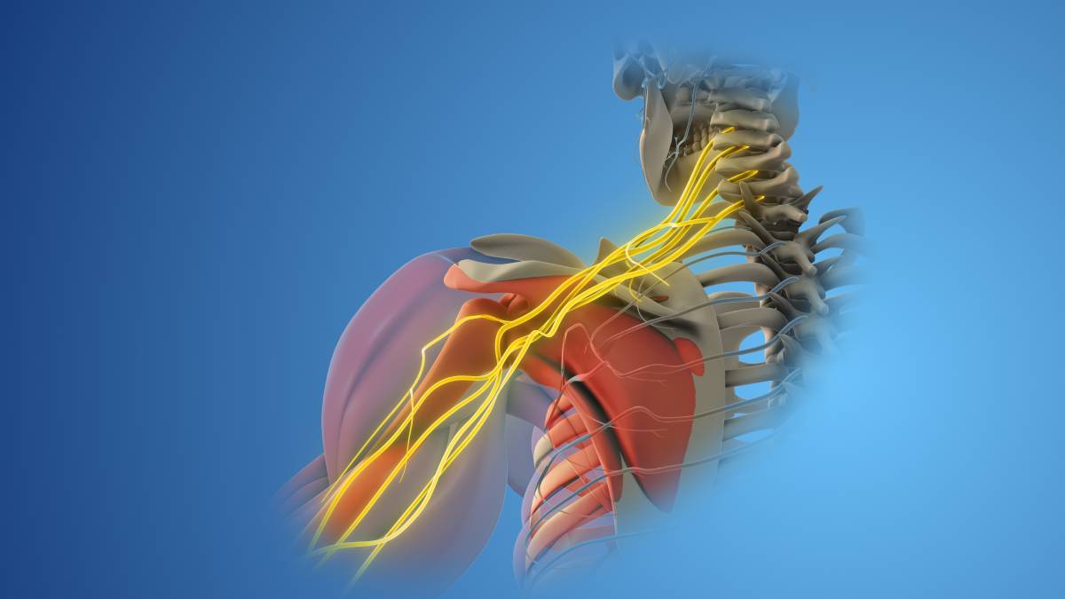 Nerve Blocks for the Arm