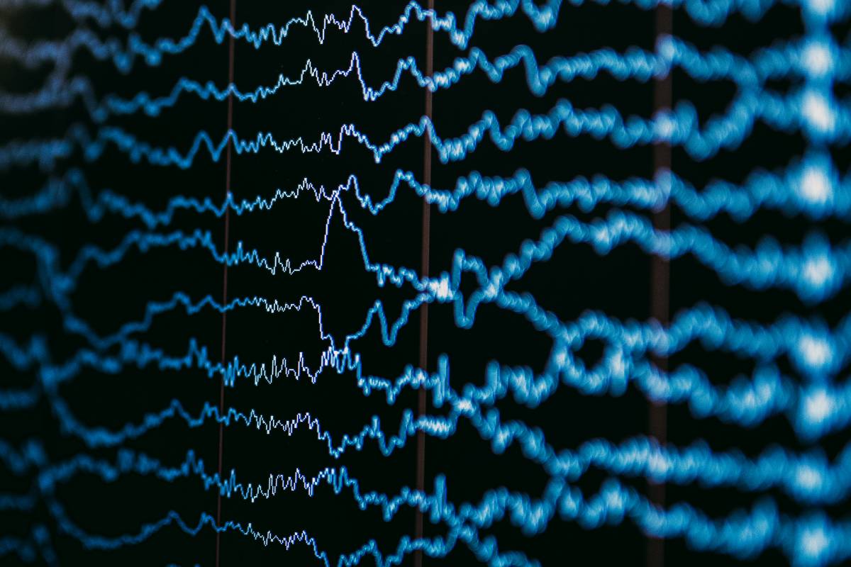 Spectrogram Interpretation of EEG Waveforms